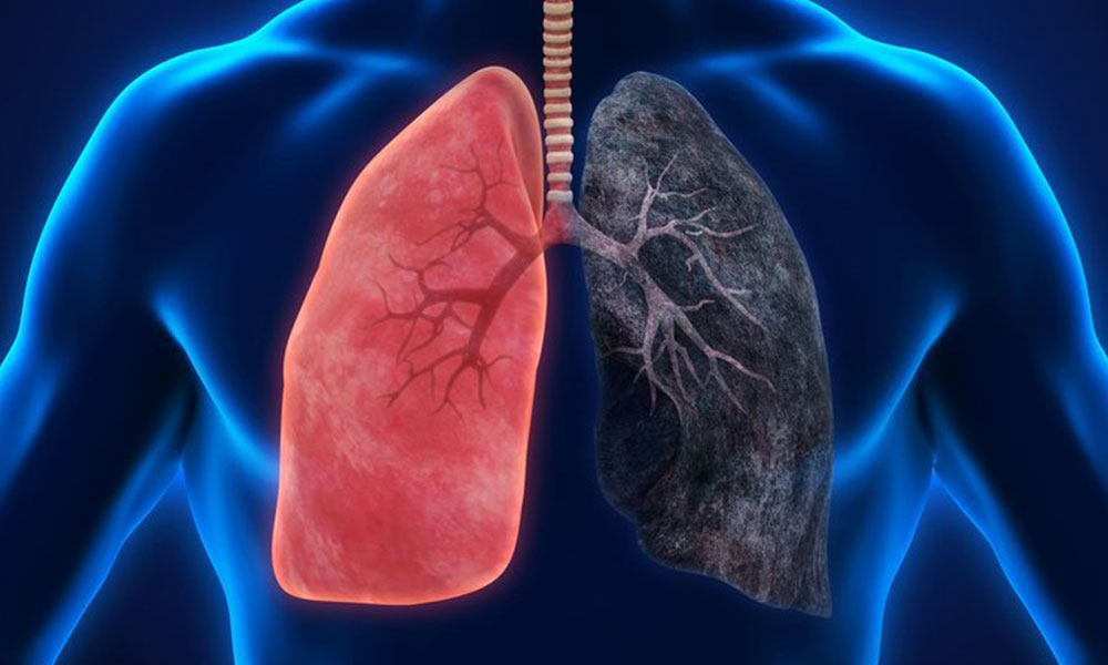 Akciğer kanseri tek nefeste teşhis edilecek