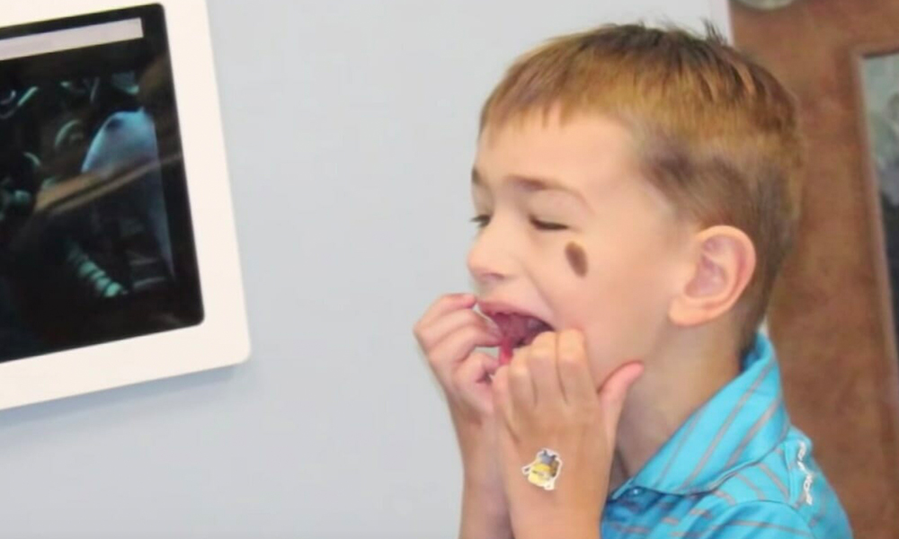 6 Yaşındaki çocuk konuşamıyordu dişçi randevusu sonrası çocuk bakın nasıl konuşmaya başladı