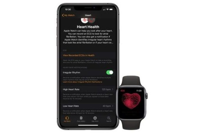 Apple Watch Türkiye’yi es geçti!