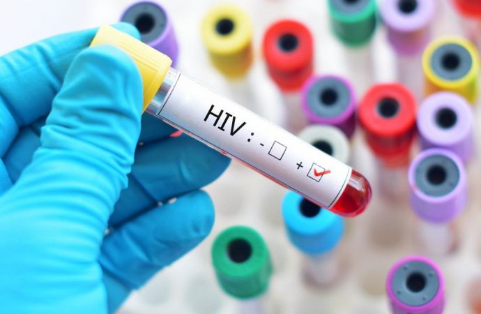 İnsanlık için büyük adım! HIV tedavisinde ikinci başarılı sonuç!