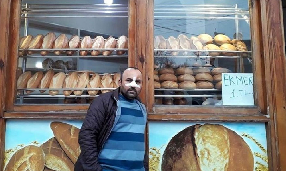 Zonguldak’ta ‘ucuz ekmek’ kavgası… Burnunu kırdılar!
