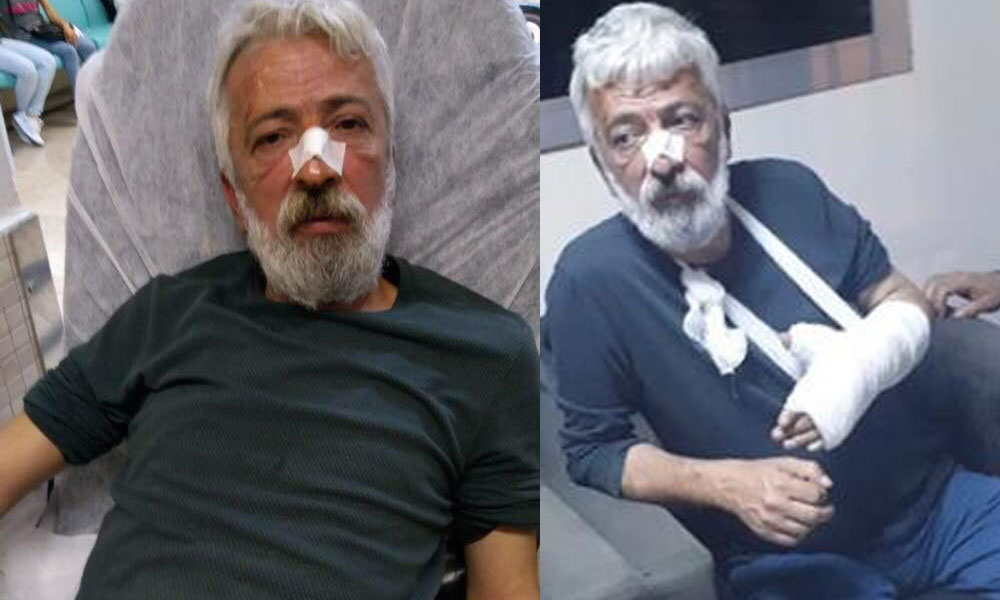 MHP’li Başkan’ın tehdit ettiği gazeteciye öldüresiye dayak!
