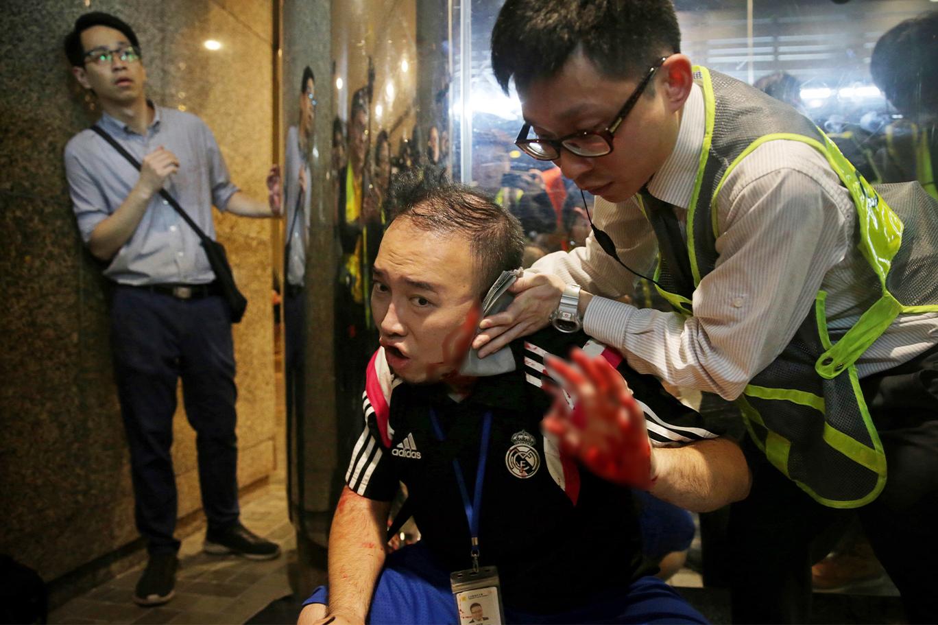 Hong Kong’da hükümet yanlısı bir kişi, meclis üyesinin kulağını ısırarak kopardı
