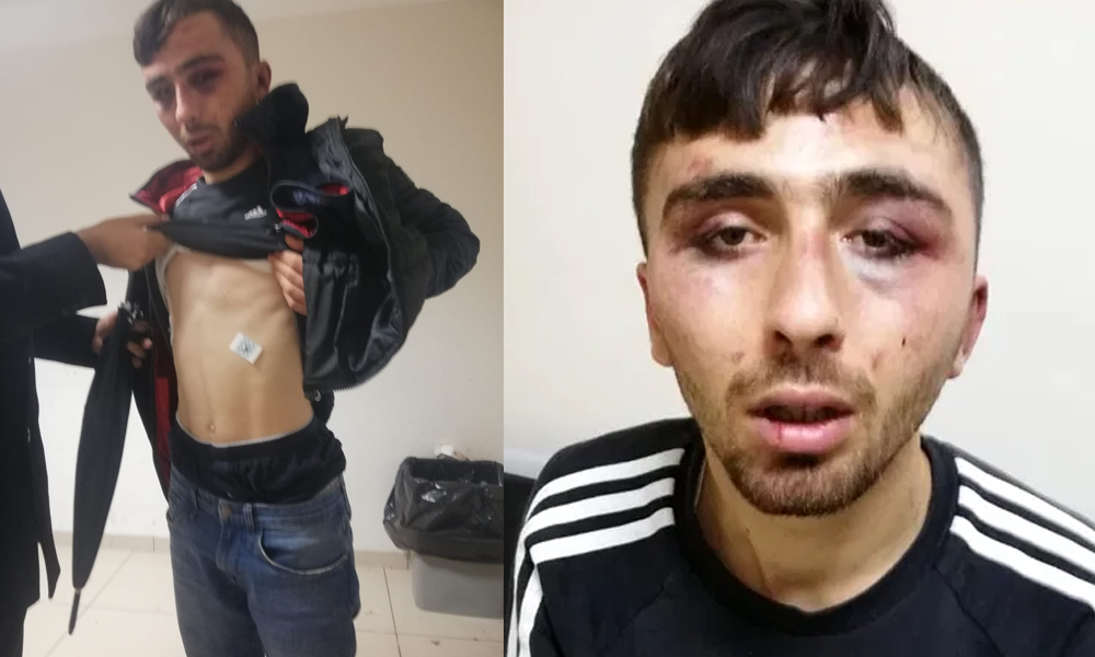 Diyarbakır emniyetinde işkence: Polisten avukata tehdit