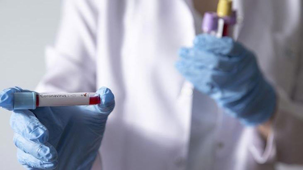 Fransa’dan, ‘koronavirüs ilacı’ iddiası: Bu virüs ile başa çıkabilmek…