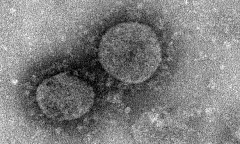 Koronavirüs belirtileri neler? Nasıl anlaşılır?