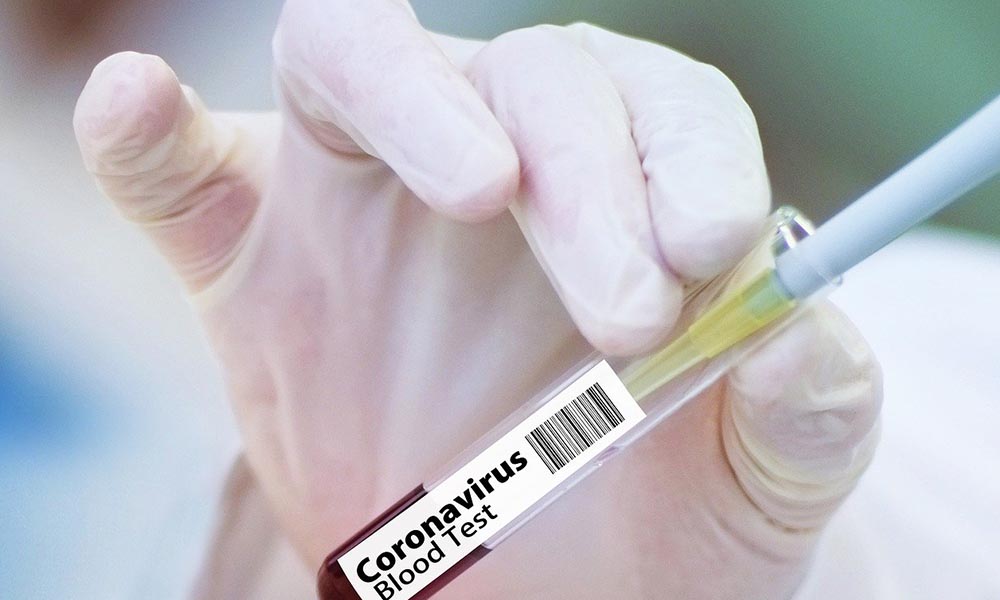 Fransız yetkiliden dikkat çeken koronavirüs açıklaması: Facia olabilir