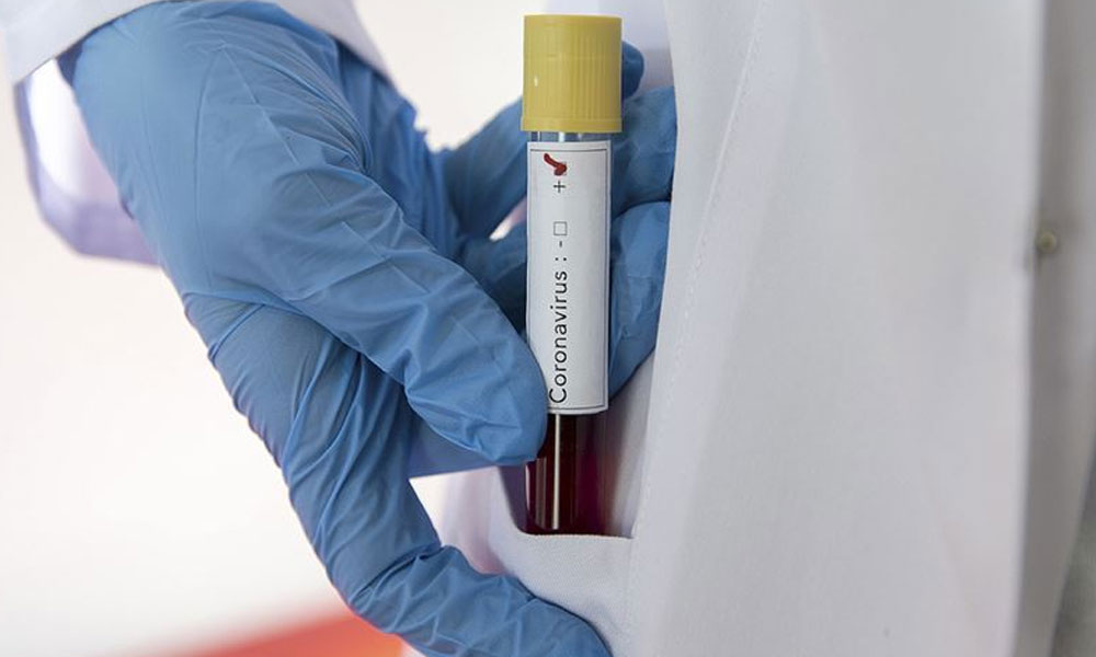 Avustralyalı bilim insanlarından sevindiren haber: İki ilaç koronavirüsü tedavi edebiliyor