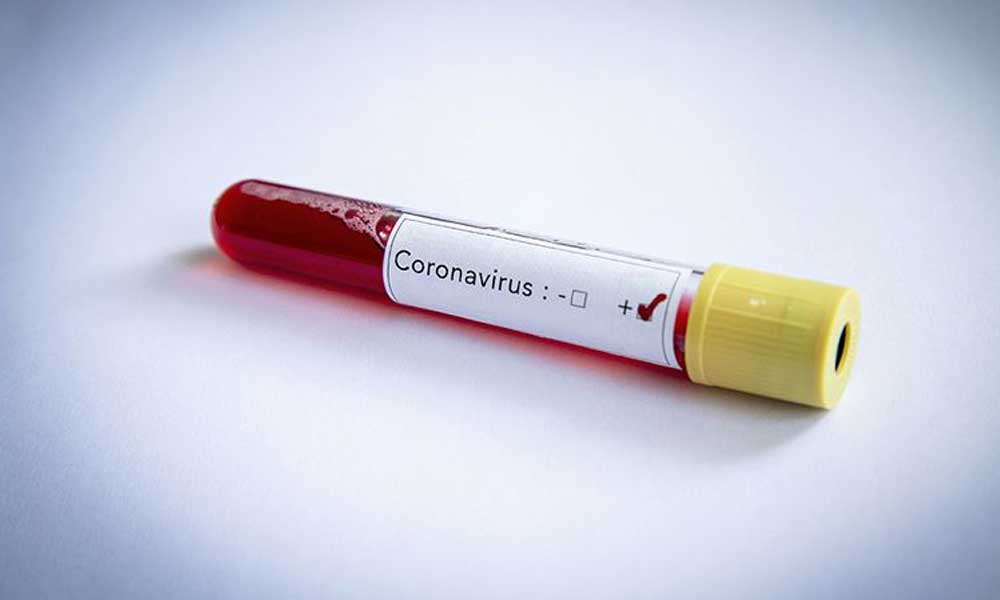 Koronavirüs testi sonuçları e-Nabız uygulamasında