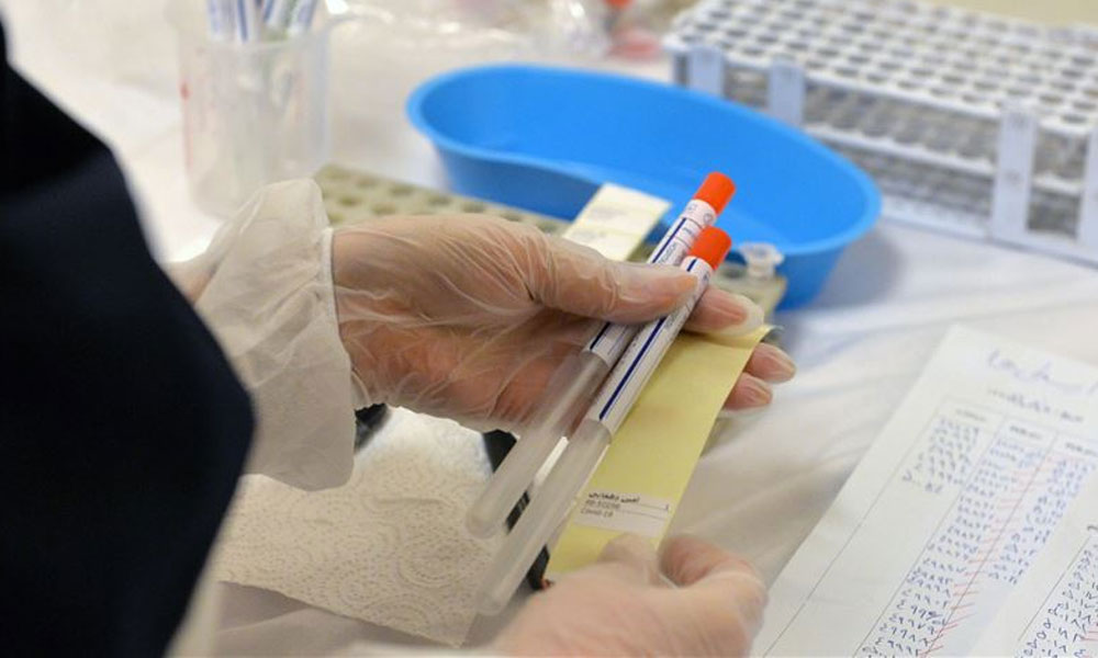 İngiltere’de 15 dakikada sonuç veren koronavirüs testleri evlere dağıtılacak