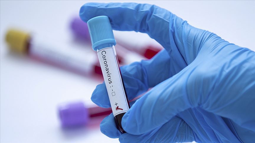 İzlanda, tüm vatandaşlarına koronavirüs testi yapacak