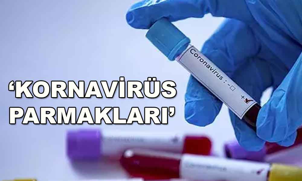 Koronavirüsün bir semptomu daha! Erken belirti olabilir