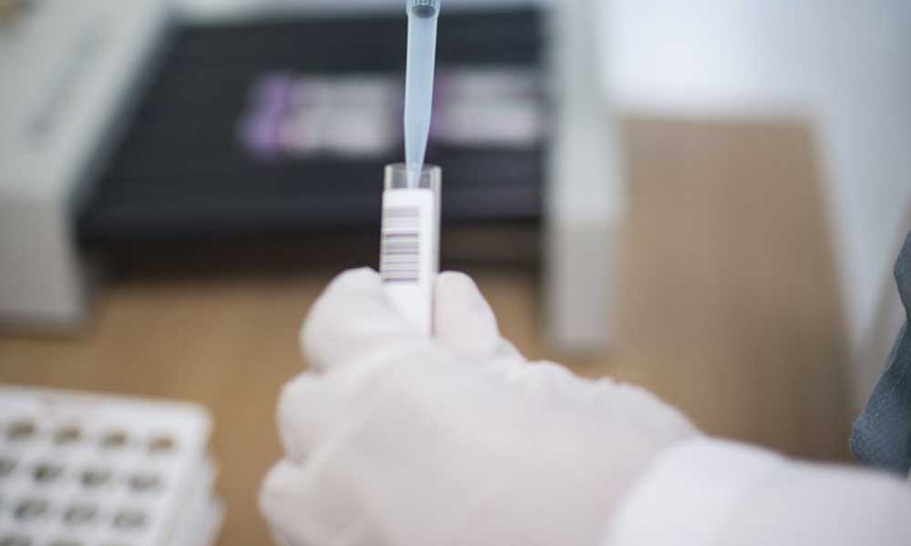 ABD, koronavirüs için ‘remdesivir’ ilacını onaylamayı planlıyor