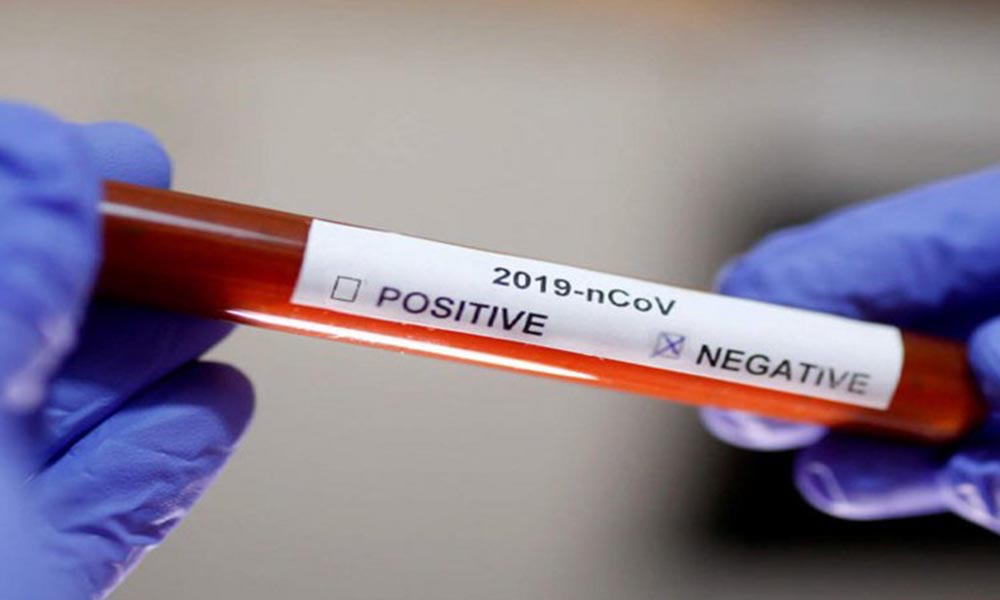 Koronavirüsten ölen bazı hastaların test sonucu nasıl negatif çıkıyor?