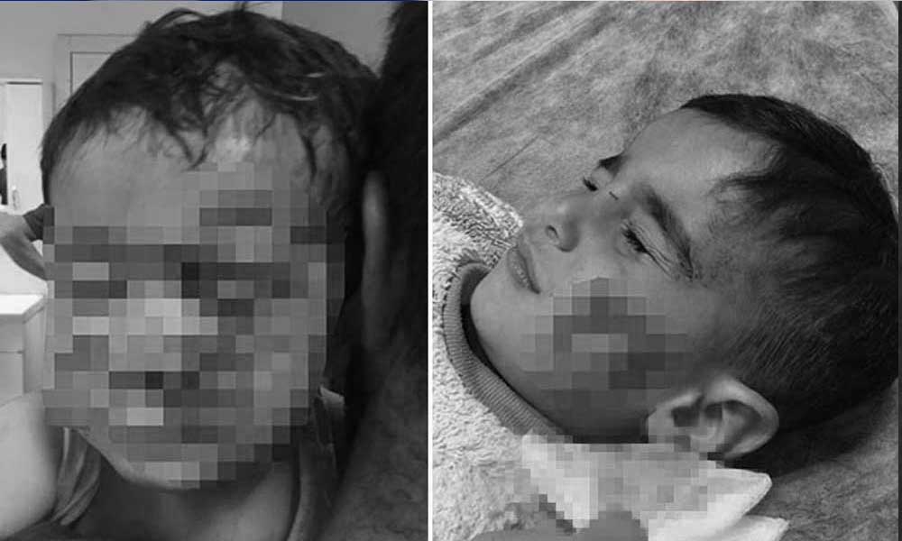 Şanlıurfa’da korkunç olay: Üçü ağır, altı çocuk yaralı