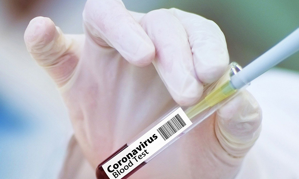 Koronavirüs aşısı için fiyat belli oldu! İşte ödenecek para…