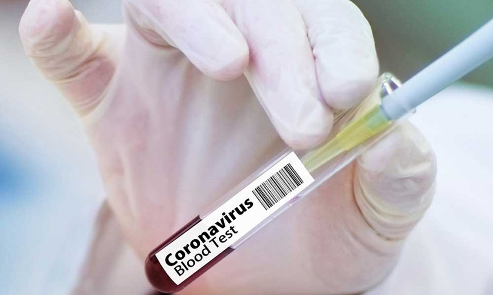 İngiliz bilim insanlarından koronavirüse karşı flaş iddia: Bulduk