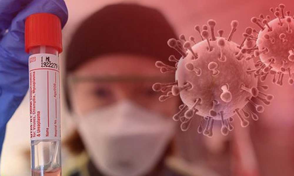 Türkiye’de koronavirüsten can kaybı 5 bin 728 oldu