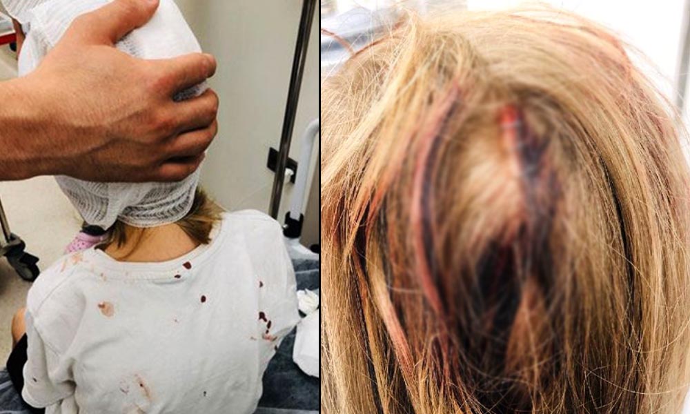 İstanbul’da 5 yaşındaki çocuğa muştalı saldırı: ‘Kötü bir abi gelip kafama vurdu’