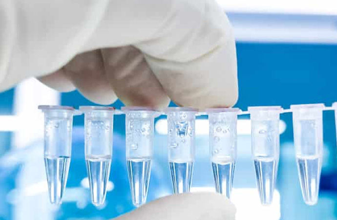 Fransa’da PCR testlerini Sosyal Güvenlik Kurumu karşılayacak