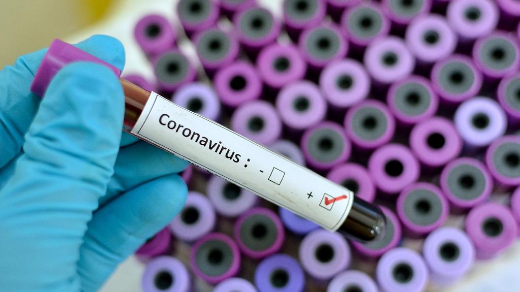 Günlük koronavirüs tablosu açıklandı! 71 kişi daha hayatını kaybetti