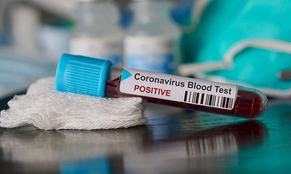 ‘Koronavirüs tiroit iltihabına neden olduğunda hayati risk artar’