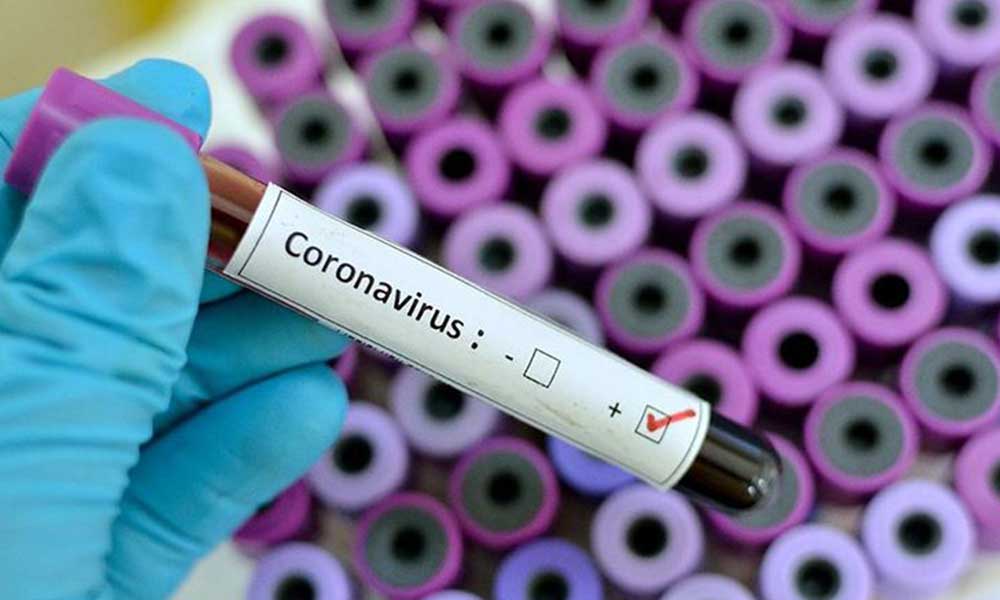Milletvekilinden flaş iddia: ‘Sağlık Bakanlığı koronavirüs verileriyle böyle oynuyor’