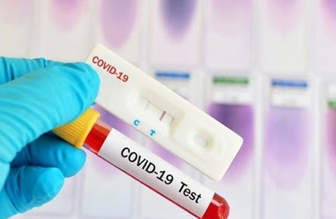 Sağlık Bakanlığı’nın koronavirüs testi aldığı şirkette FETÖ detayı
