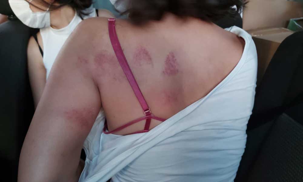 Pınar Gültekin eylemine saldıran polisler, darp ettikleri kadınlardan şikayetçi oldu