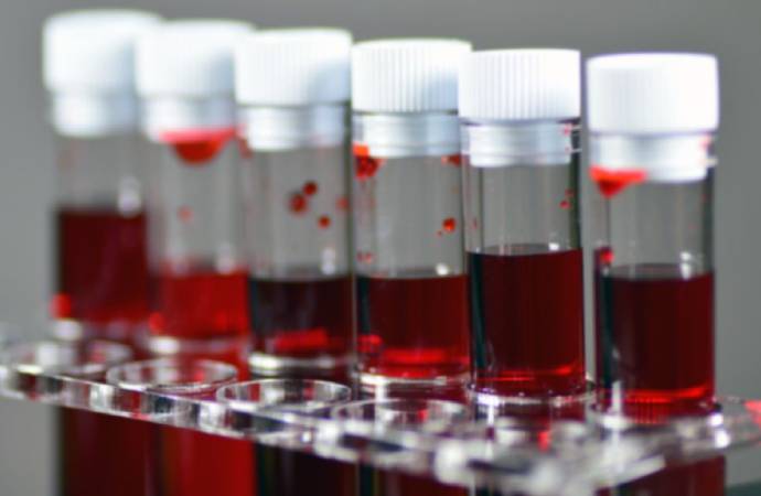 Araştırma: Koronavirüse karşı en şanslı kan grubu hangisi?