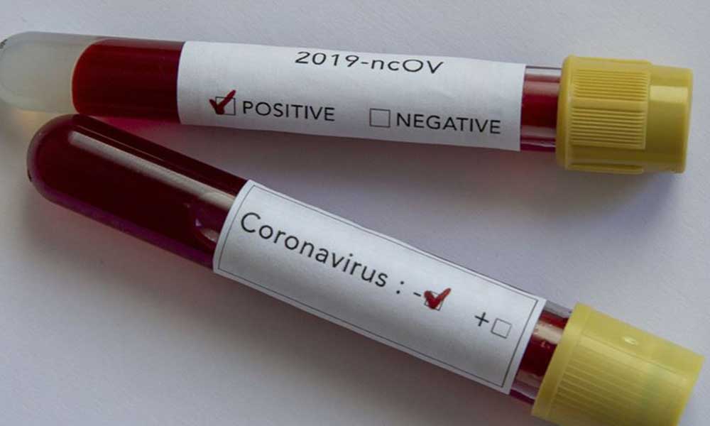 Araştırma: Koronavirüse yakalananların 6 ay boyunca tekrar hasta olma olasılıkları çok düşük