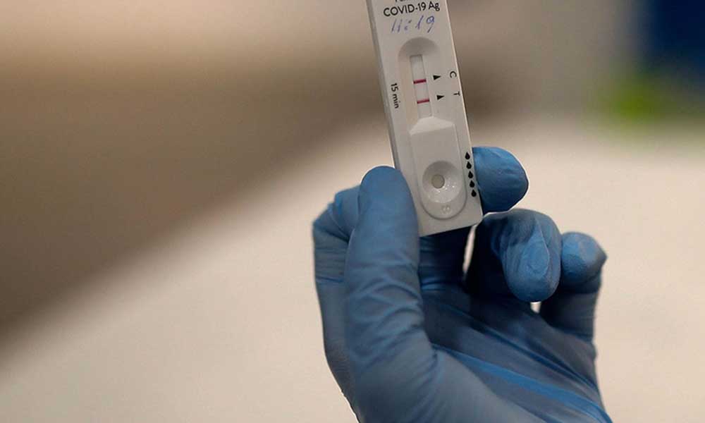 ABD’den koronavirüs ev test kitine onay