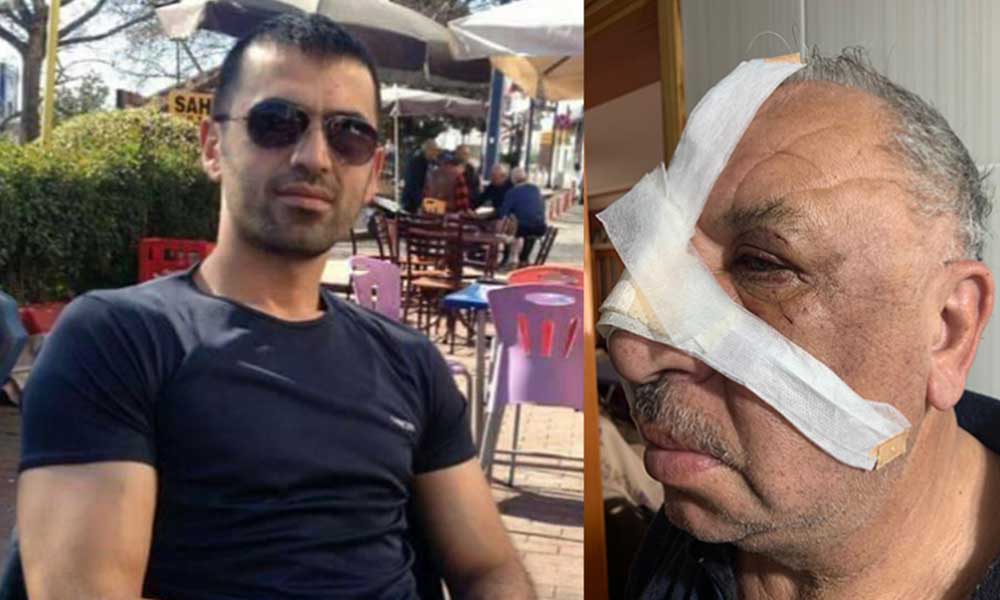 Kıyak atamayla gündeme gelen imam şehit babasının burnunu kırdı