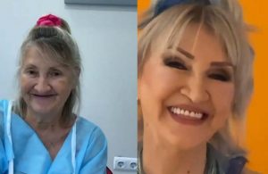 67 yaşındaki kadının estetik operasyonu sonrası inanılmaz değişimi