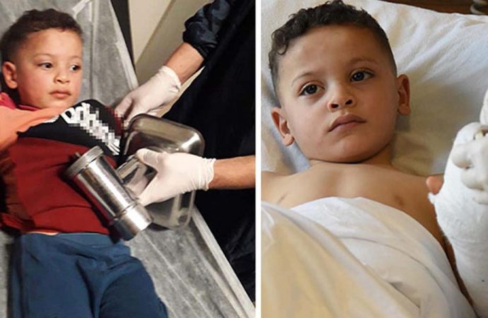 3 yaşındaki Ahmet, elini kıyma makinesine kaptırdı