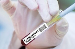 Koronavirüs aşısı olanların sayısı, hastaları geçti