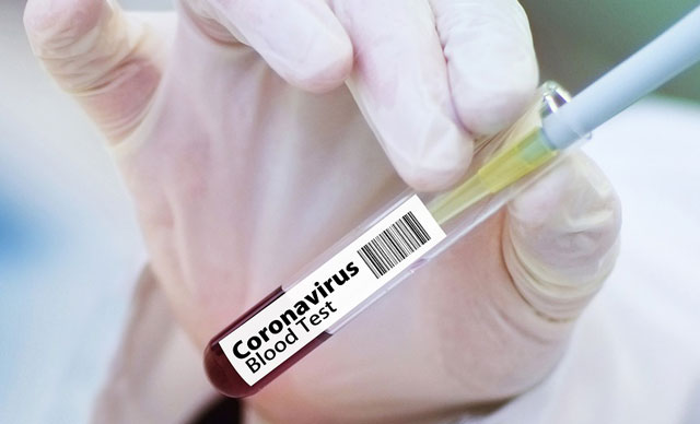 Koronavirüs aşısı olanların sayısı, hastaları geçti