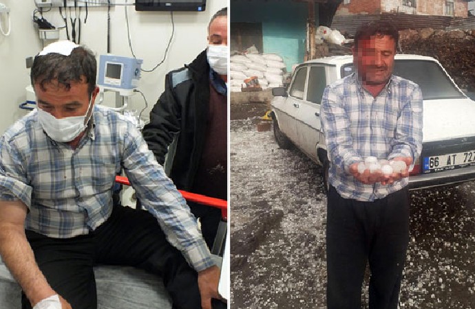 Yozgat’ta dolu yağışı hastanelik etti