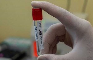 KKTC’de aşı olmayanlar, PCR testini ücretli yaptıracak