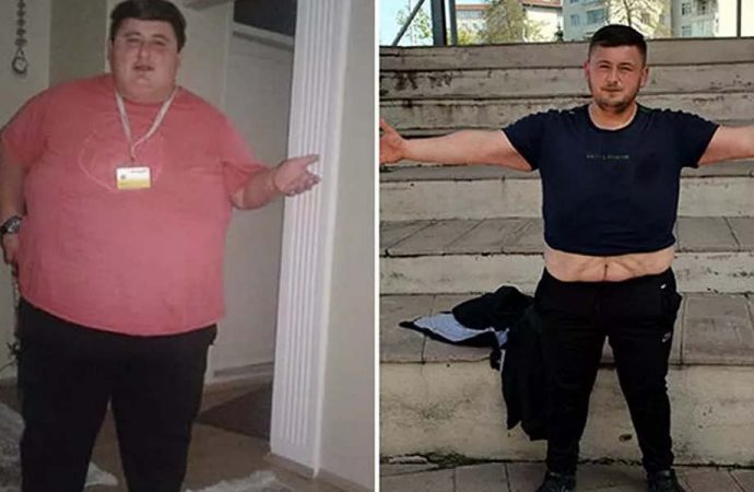 6 ayda 212 kilo vermişti: Yeniden gündeme geldi