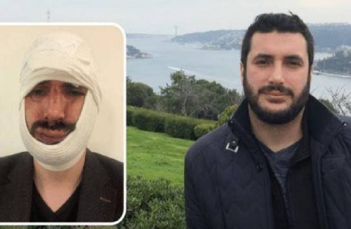 Anadolu Ajansı muhabiri darp edildi, çenesi kırıldı
