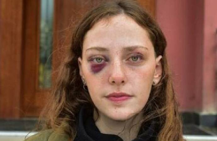 Boğaziçi Üniversitesi öğrencisi gözaltında darp edildi