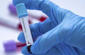 Koronavirüsten bir günde 187 kişi hayatını kaybetti Bakan aşı için uyardı