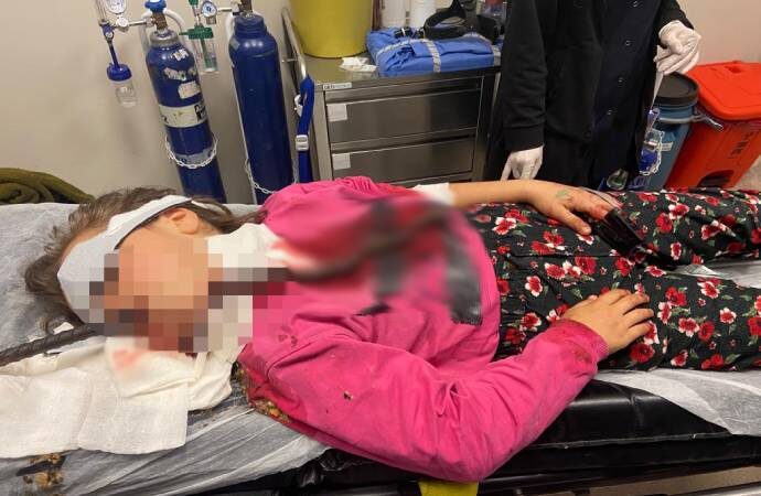 Boğazına demir çubuk saplandı! Küçük kızın sağlık durumu kritik