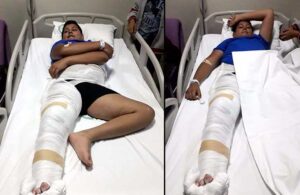 Fizik tedavide bacağı kırılan çocuğun annesine hapis cezası