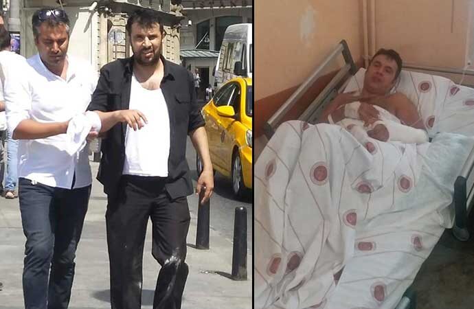 Polis müdahalesinde kolu kırılan Aydın Aydoğan’dan Soylu’ya suç duyurusu
