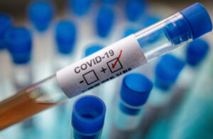 Koronavirüste son 24 saatte bin 778 vaka