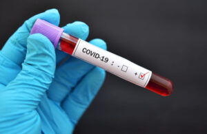 Koronavirüsten bir günde 10 ölü, bin 154 yeni vaka