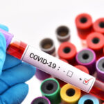 Koronavirüste son 24 saatte bin 608 vaka