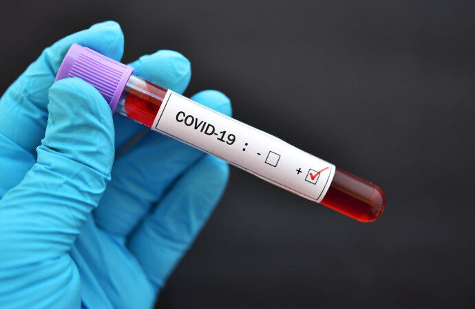 Koronavirüste sil baştan! “Gerçek veriler saklanıyor”